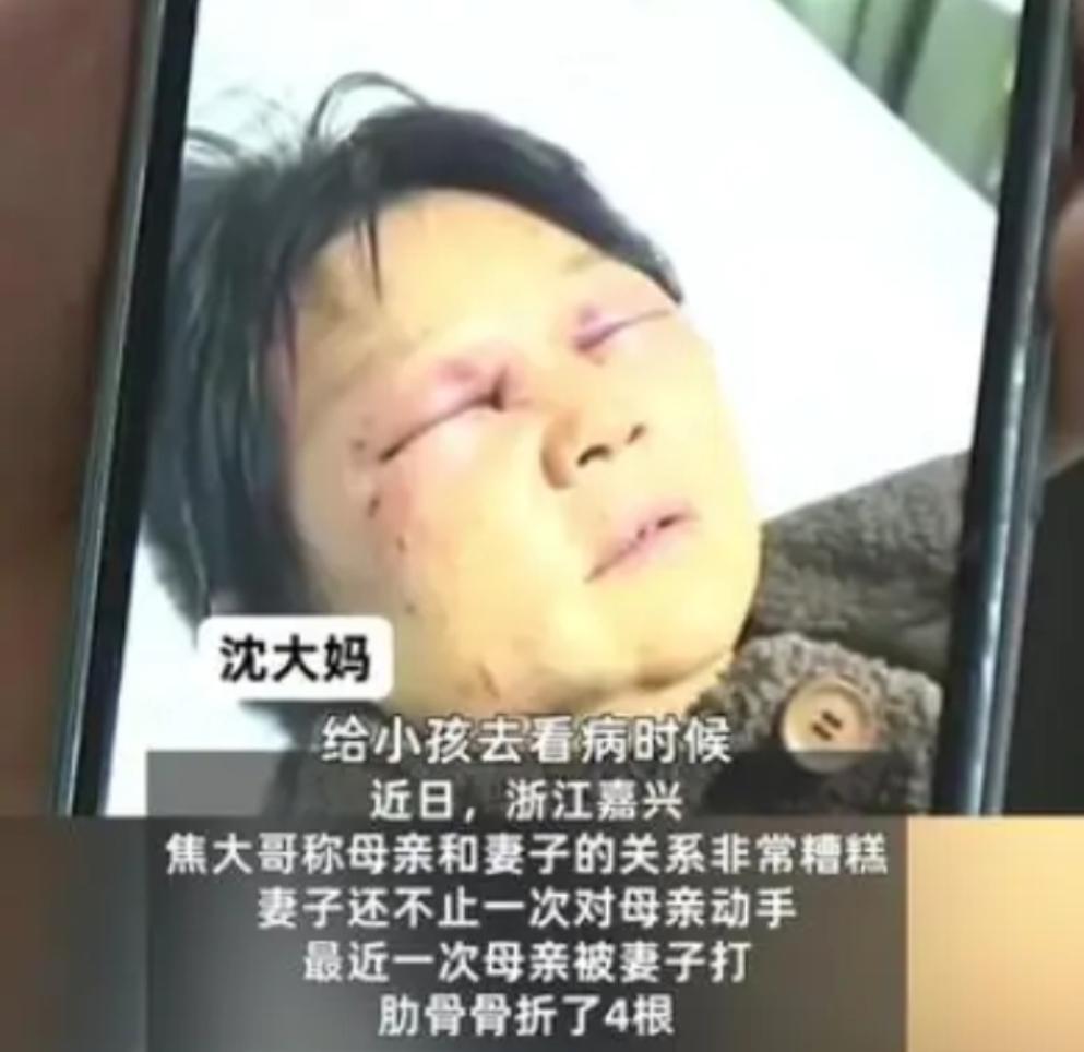 媳妇打断母亲四根肋骨，儿子却说活该！浙江海宁这件事，看完后真的是浑身发凉。
 