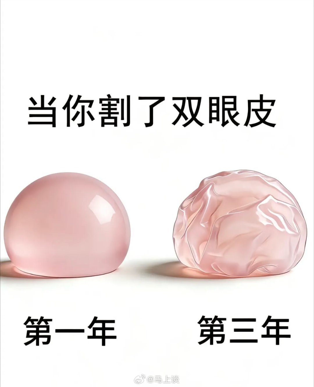 我突然发现一个规律：医美失败大多数是女性…开个玩笑，其实我想说，双眼皮这么小的一