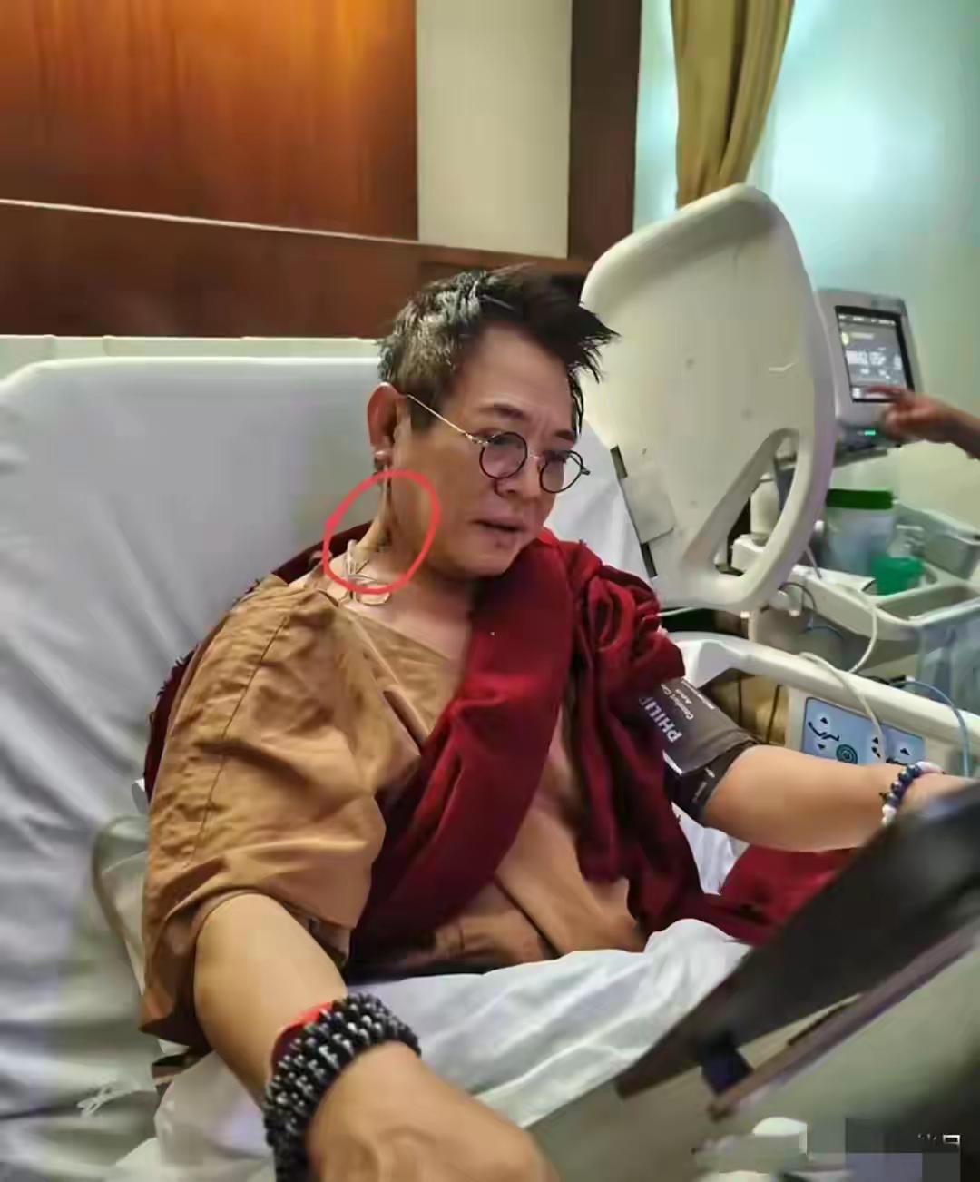 李连杰这个手术也是遭大罪了，脖子上动那么大一刀，确实风险很大，颈部有丰富的神经分
