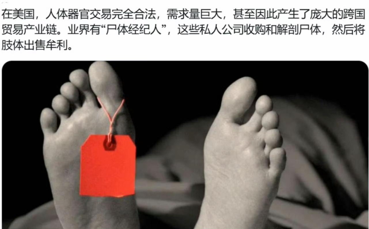 美国记者调查美国买卖遗体。美国斩杀线