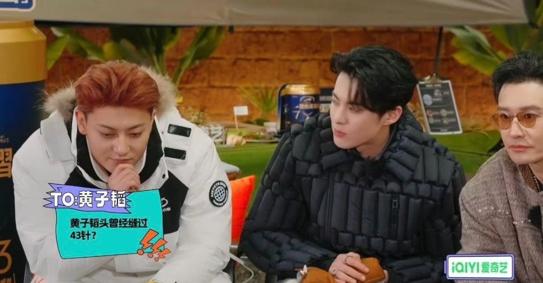 黄子韬因脑淤血手术缝了43针真的心疼了，头皮掀开做手术想想都觉得疼啊