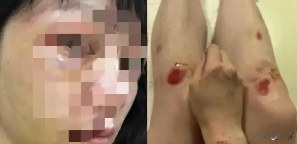 福建厦门，一名女子常年遭丈夫家暴，被打得实在撑不住后连夜离家，独自在外漂泊五年，