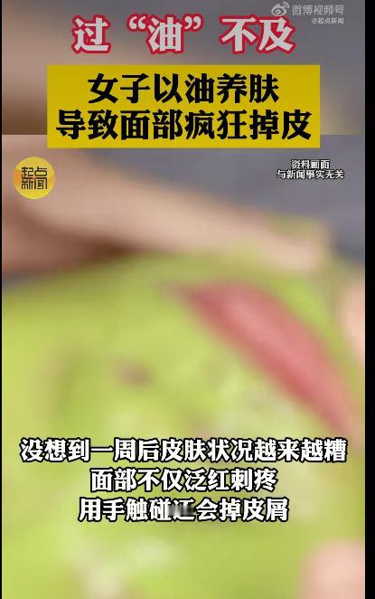 福建福州的林女士因为盲目跟风“以油养肤”，结果把自己折腾进了医院。这事儿听着离谱