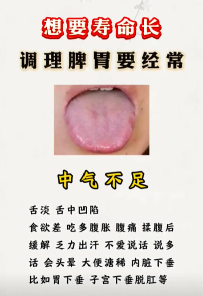 中气不足、肝郁脾虚、脾胃虚寒！5 种脾胃问题舌象汇总