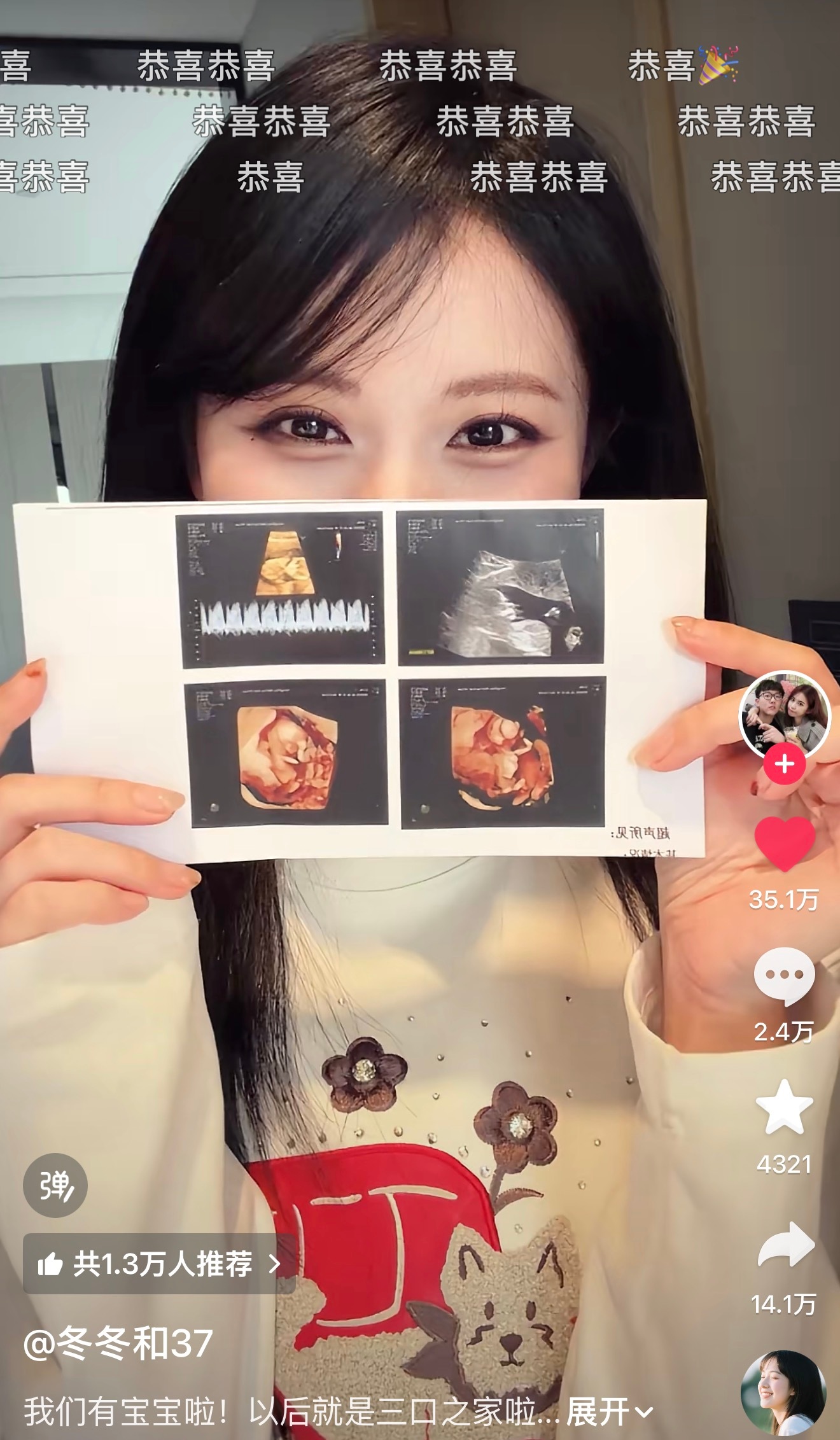 我去！冬冬和37都有孩子了！我感觉我从上初中时候就刷到过他俩！ 