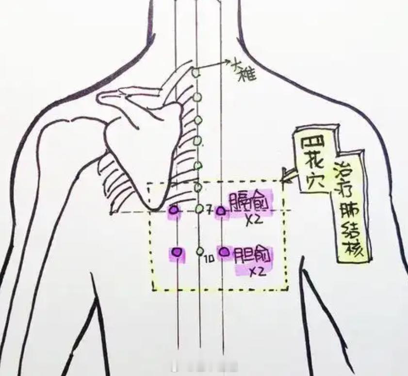 既有补血养血作用，又有活血化瘀作用的大穴，膈腧穴。尤其女性情绪紊乱，导致身体气机