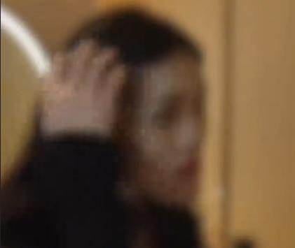 24岁女模正颌手术被反做，“猪腰子”脸型让其快速失业！

根据报道，这起事件发生
