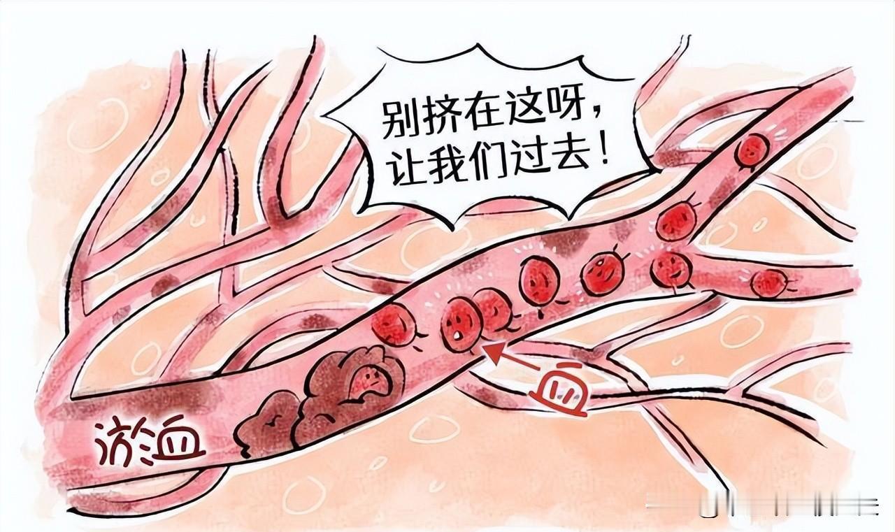 血管越通，命越长！4个厉害的中成药，通瘀血、通经络、通血管！

一、血府逐瘀丸
