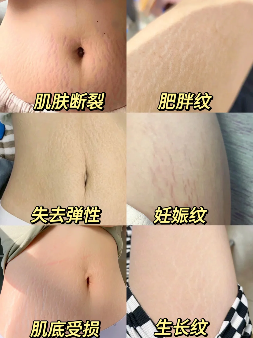 终于遇到祛纹界心软的神！！！