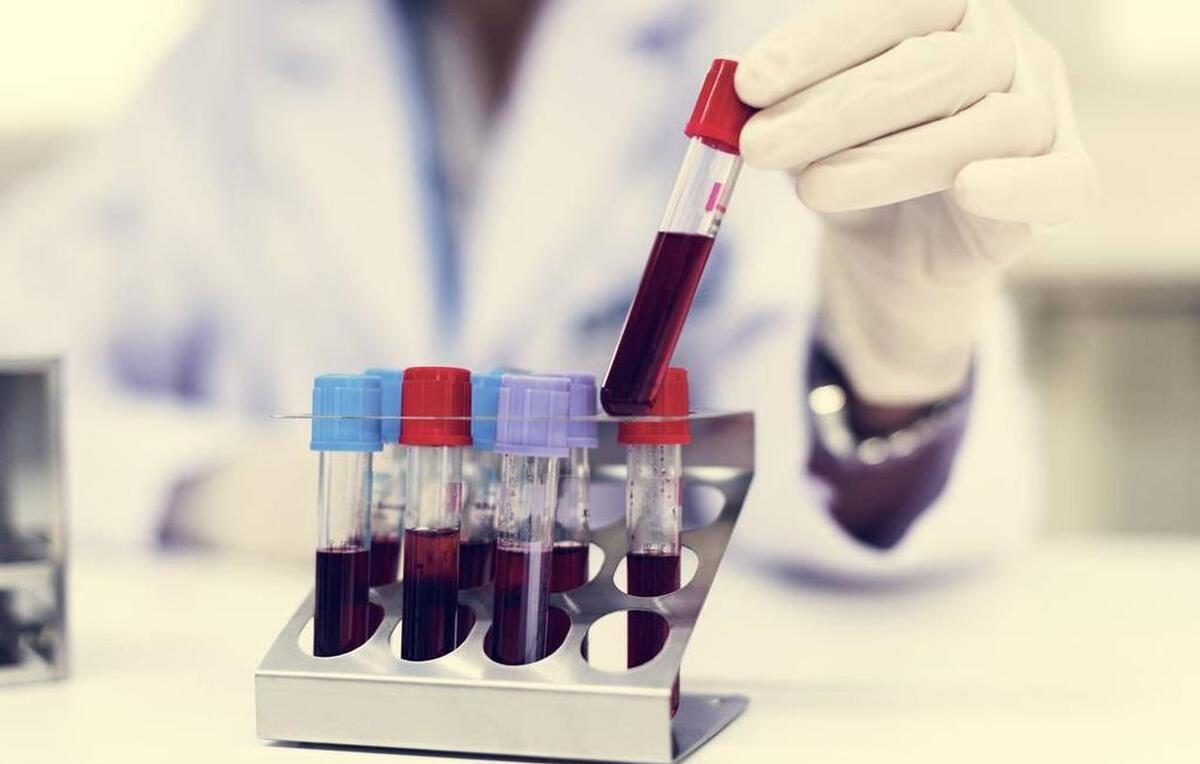 为什么，没人去控制脂蛋白（a）的风险？
1、他汀类药物：他汀类药物可以大幅降低L