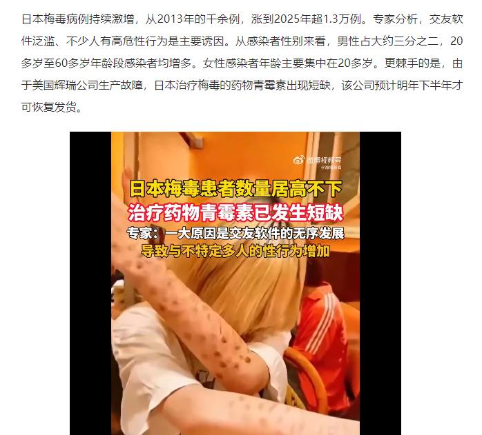 在日本出现这种状况，实在算不上意外。
日本的梅毒病例近年持续猛增，从2013年的
