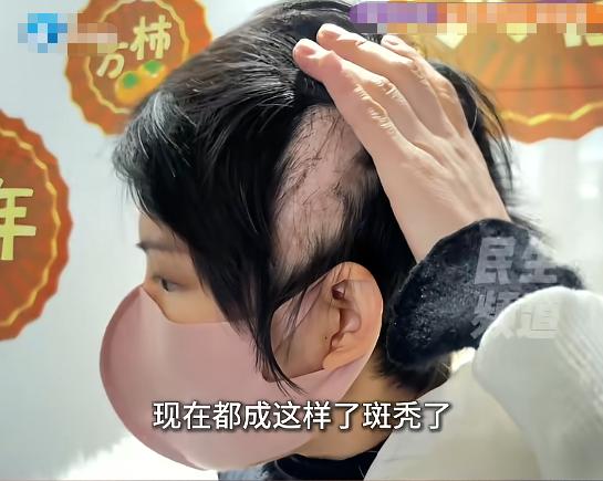 “悲剧还是发生了！”2月23日，河南，一女子在美容院的推销下，往头皮打了玻尿酸，