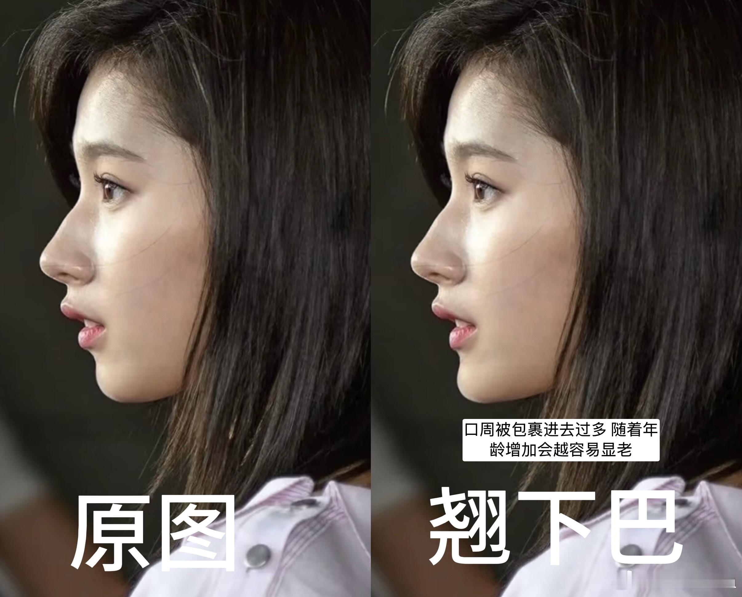 很对人对侧颜的审美是侧脸一定要守住这条E线因为鼻子的高度加上下巴的的兜翘会弱化嘴
