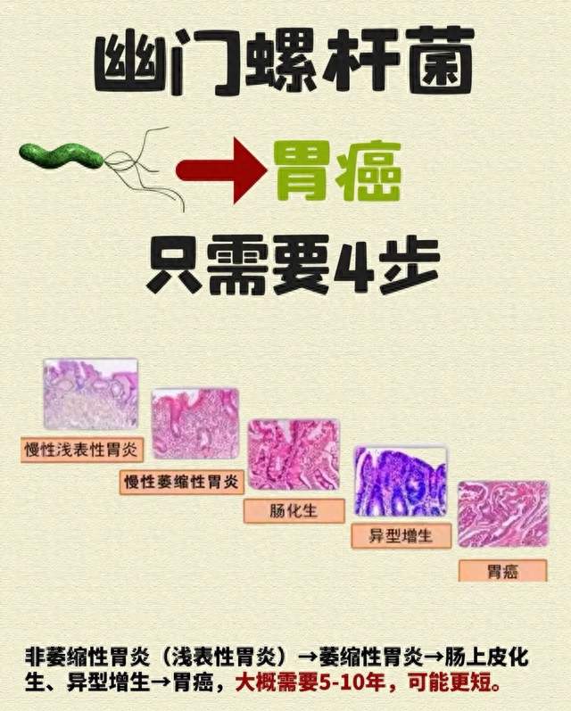 读懂胃癌：从预防筛查、精准治疗到术后长效养护的完整指南