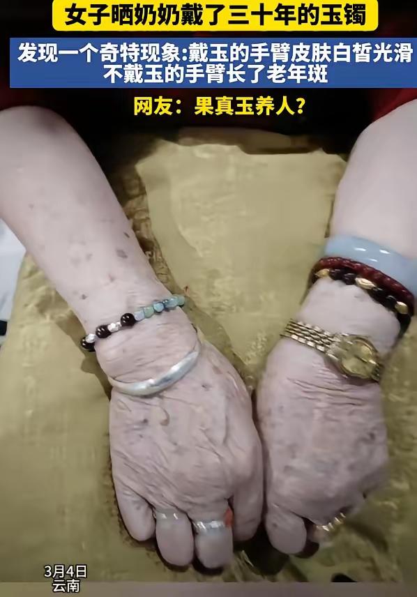 玉镯到底是玉养人，还是人养玉？云南一个姑娘最近留意到，奶奶戴了三十年玉镯的胳膊，