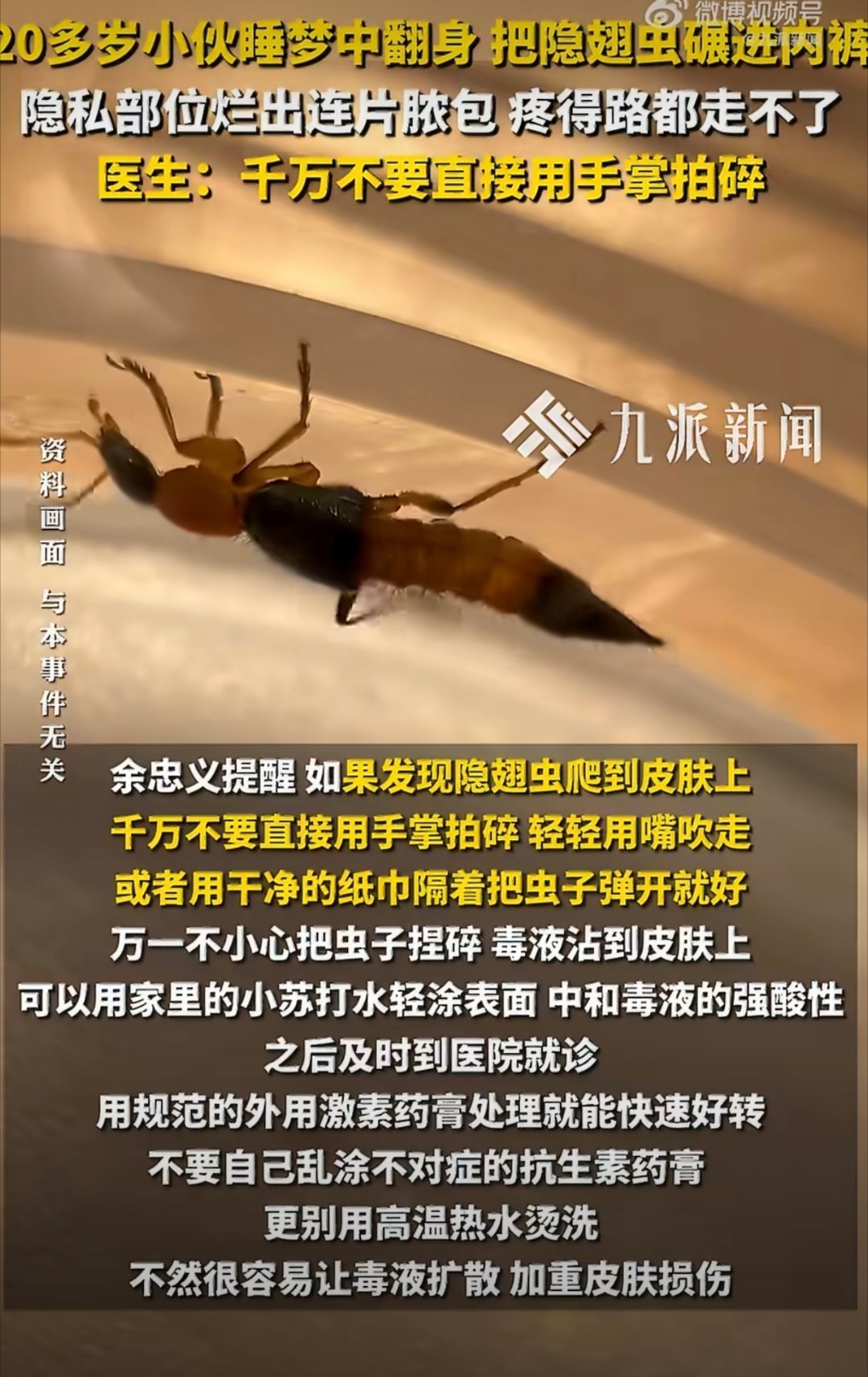 小伙睡梦翻身把隐翅虫碾进内裤隐翅虫真正可怕的，不是“咬你”，而是你不小心把它拍碎