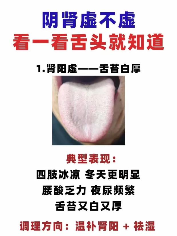 你的肾阴足不足？看看舌头就清楚