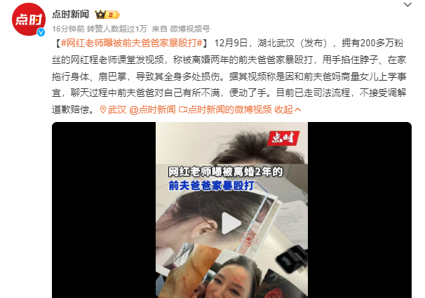 网红老师曝被前夫爸爸家暴殴打  都离婚了不能称家暴了吧！这应该是严重的故意伤害吧