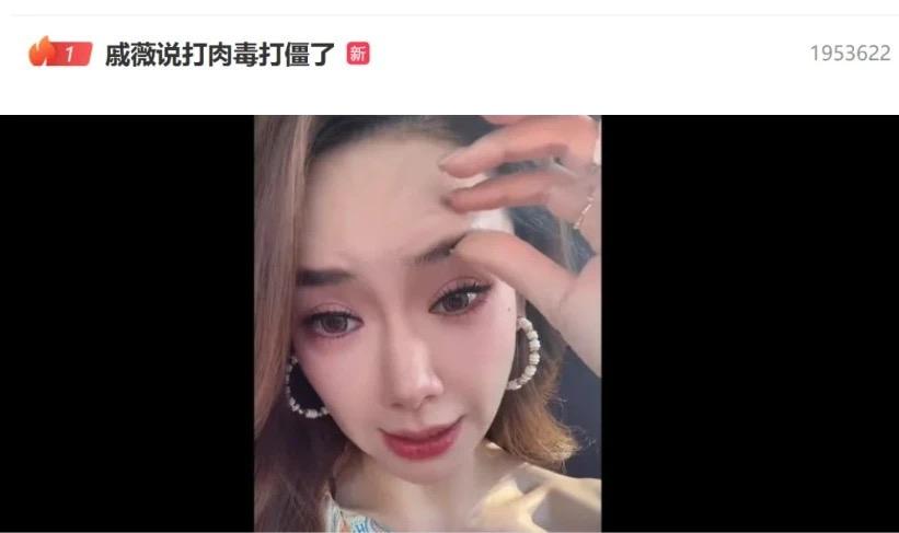 “敢说姐”戚薇再次自曝医美过度： “打僵了，整个眉毛完全动不了，压眼睛，过量了。