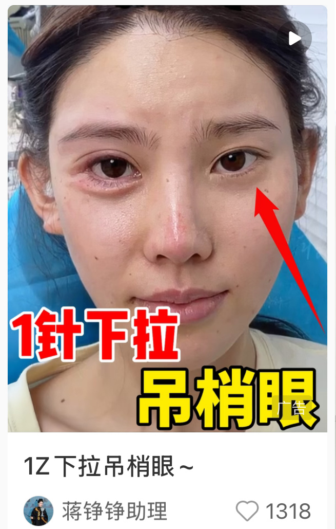 把卧蚕打成卧铺又何必呢 