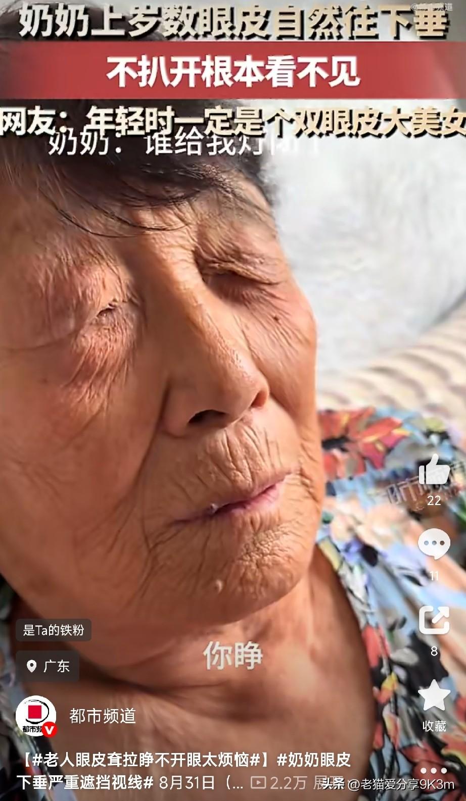 刷到一条新闻，心里挺不是滋味的。广东有位奶奶，年纪大了之后上眼皮严重松弛下垂，重