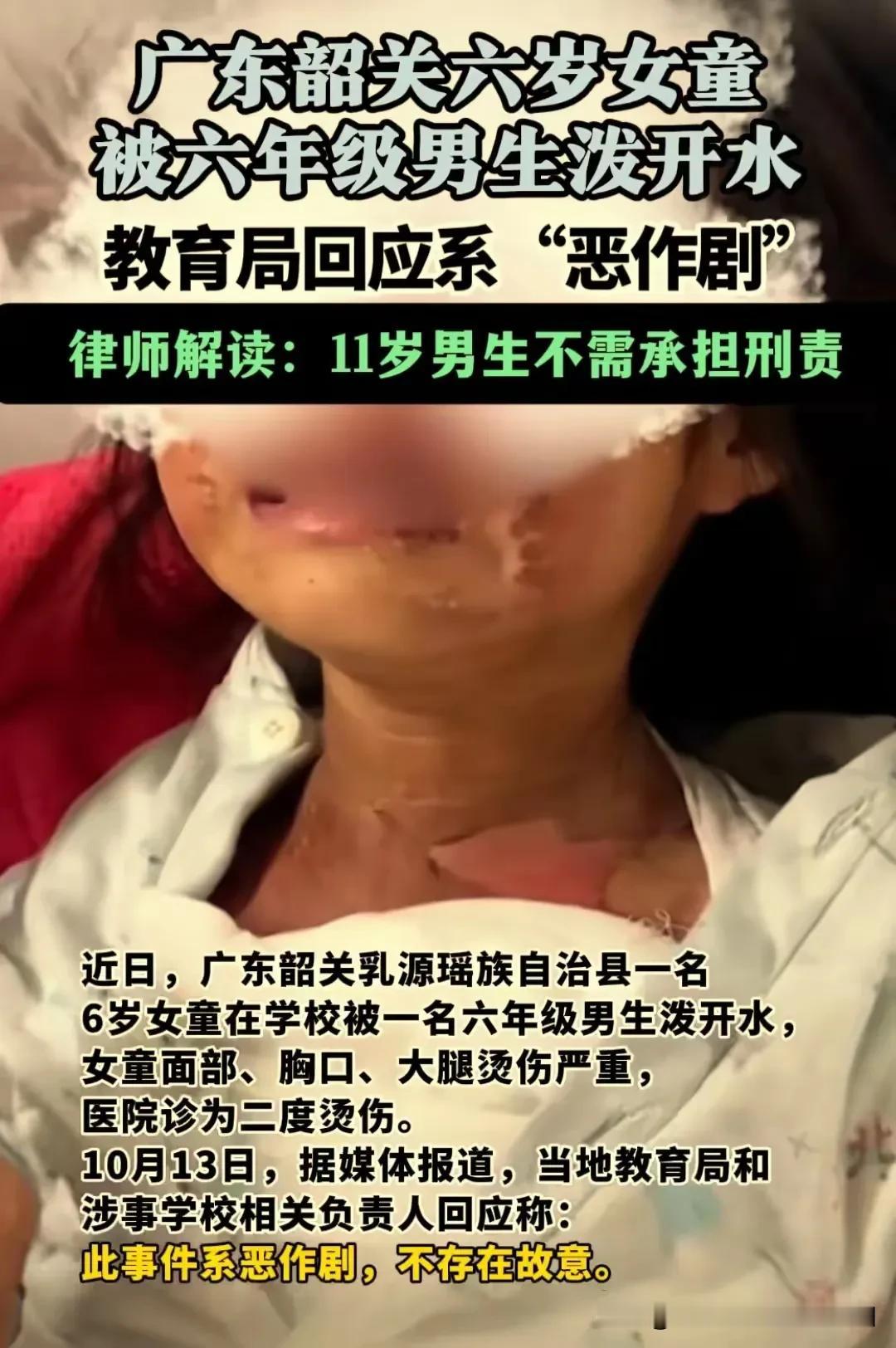 广东韶关11岁六年级男生，向6岁女童泼开水，造成女童面部、胸口、大腿严重烫伤，被