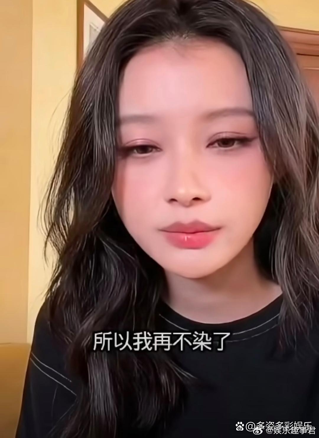 孙怡因染发导致脸肿孙怡直播中透露自己不敢染发的原因：她上次染完发后整个脸都肿了起