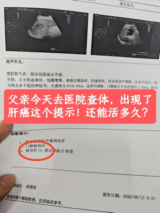 前天我公司组织体检，让带着家里老人一块去查查，我就带着我爸妈去了。结果...
