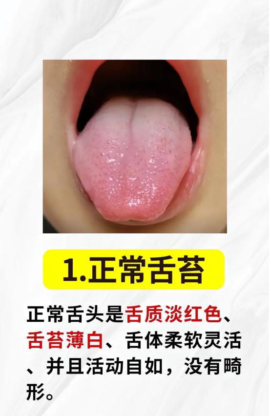 身体不好，舌先知！以下这几种舌象，你是哪一种？





#中医##健康#