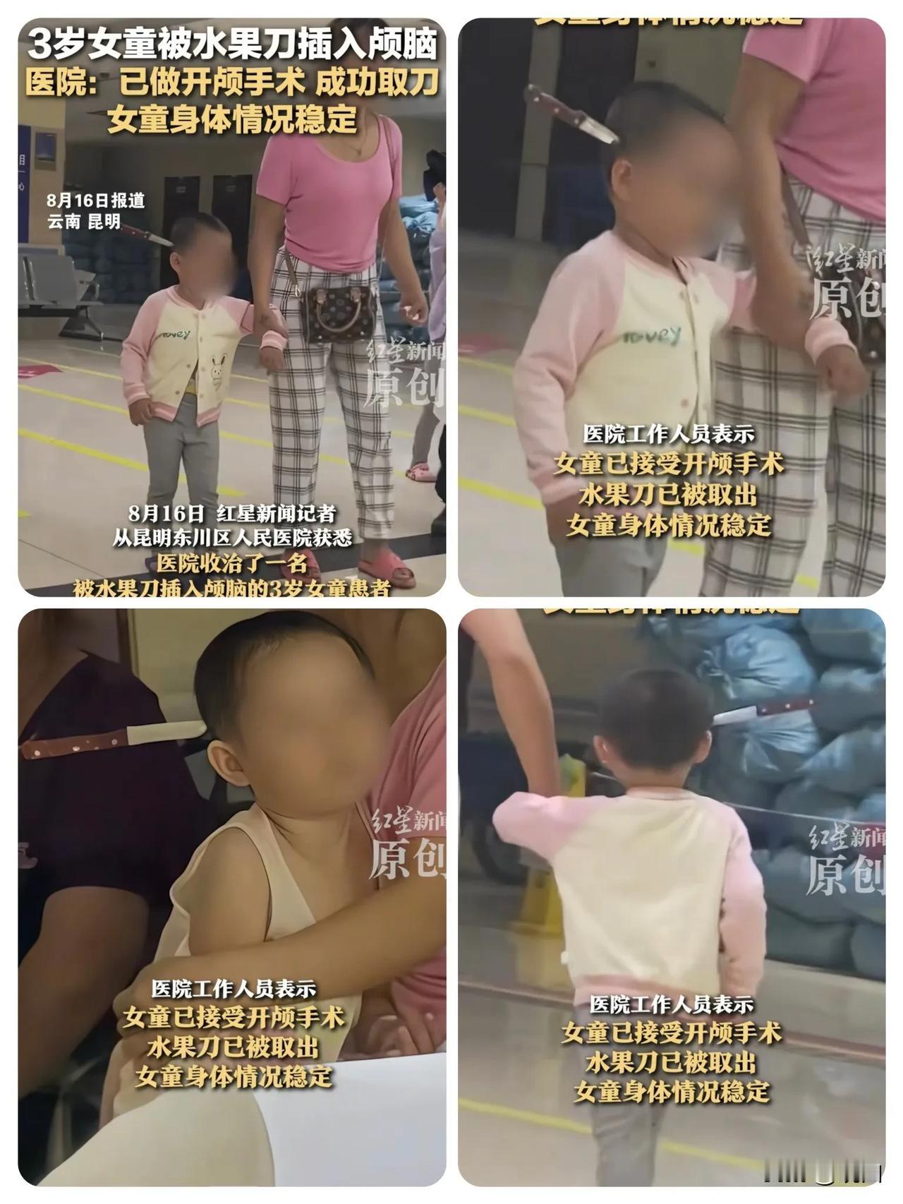 “彻底解释不清了！”云南昆明，一位女子拉着三岁的女儿走进医院，女儿的头上还插着一