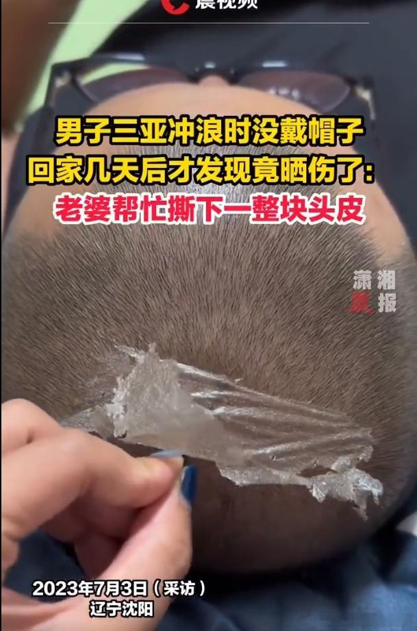 当你出门玩没有做好防晒......[喵喵]（图源网络） ​​​