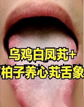 我以前一直以为，乌鸡白凤丸是女人吃的。
直到一个懂行的哥们儿点醒我，我才发现自己