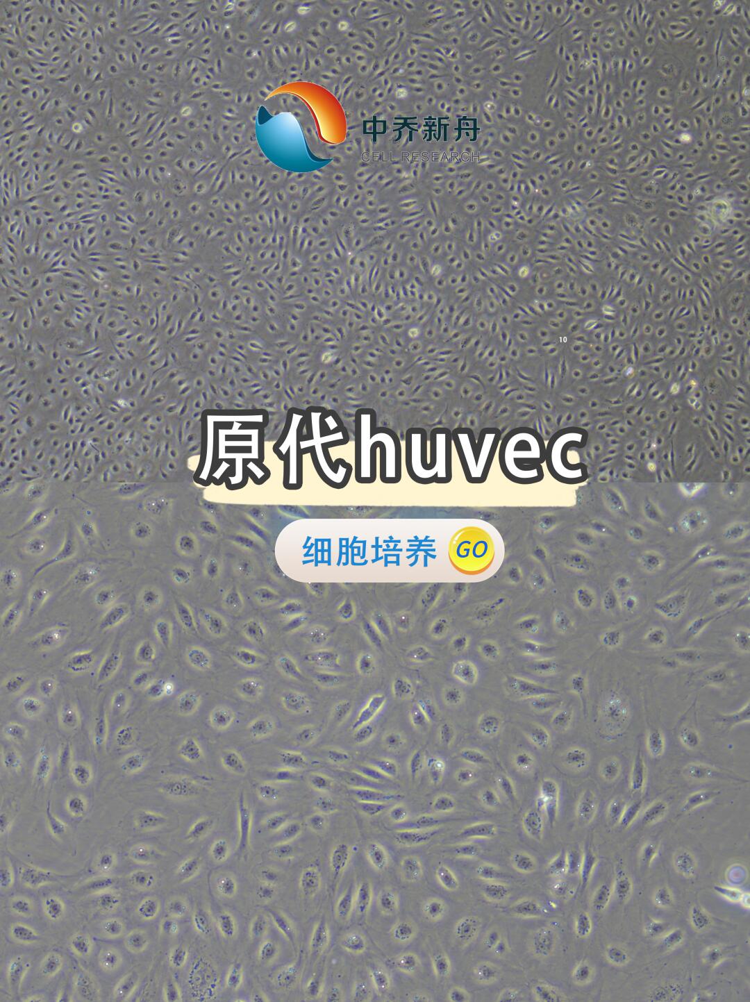 家人们！你们的原代Huvec状态咋样啊？