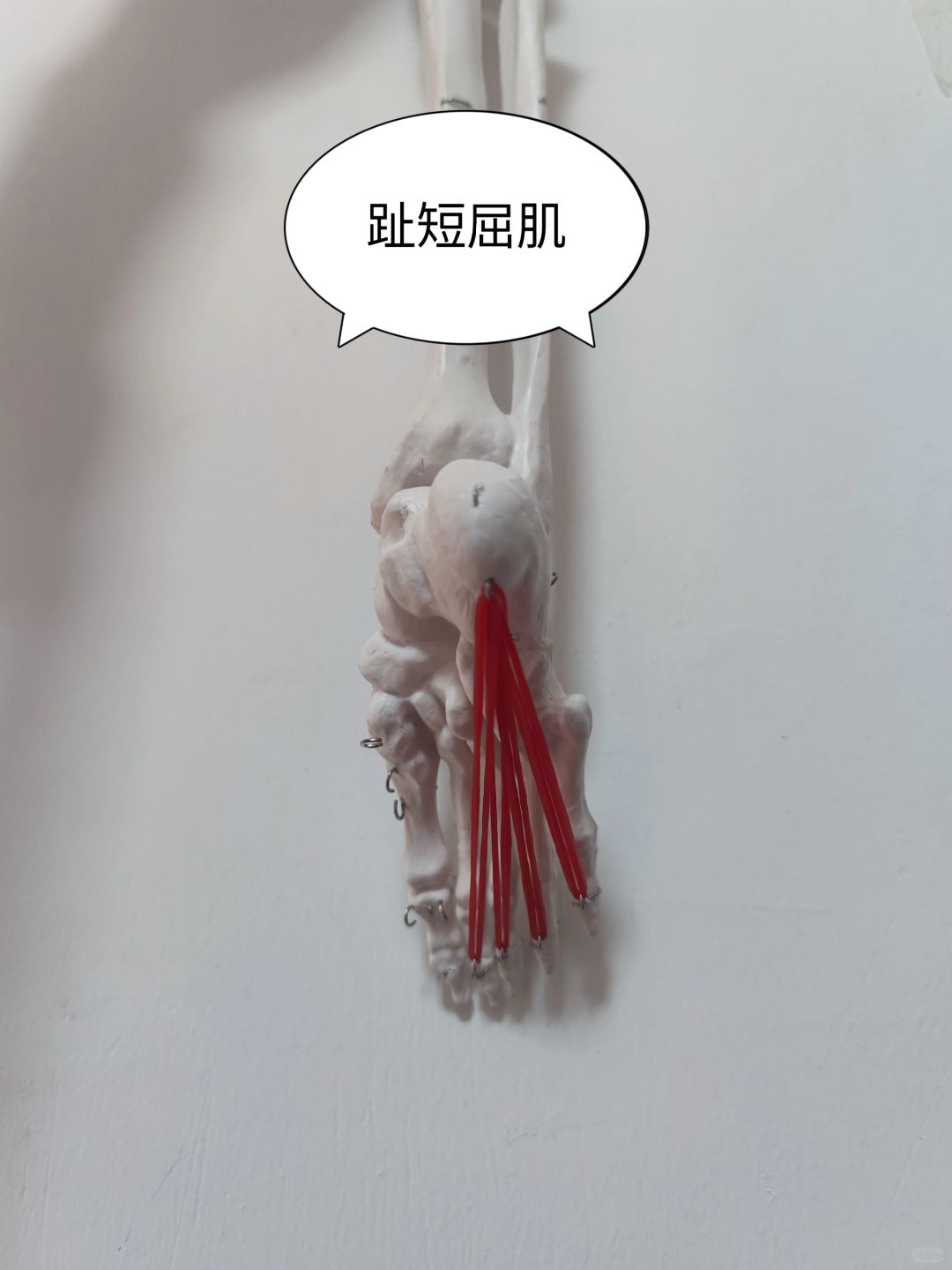 趾短屈肌