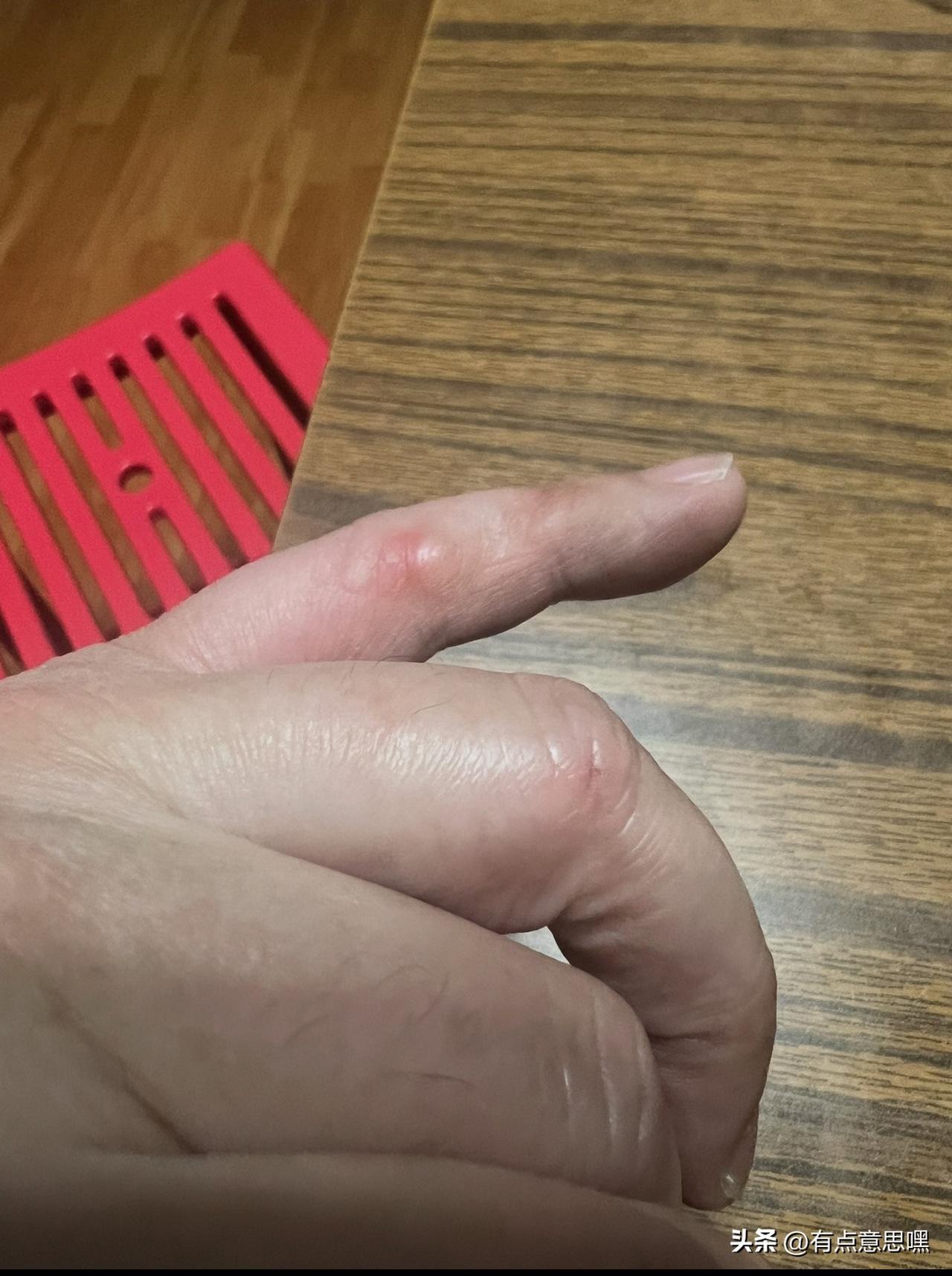 您猜猜，这是干啥活磨出的茧子

做了一辈子牛马，双手没有磨出老茧。

整了一个玩