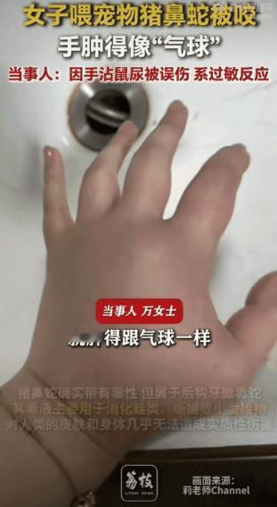江苏一女孩养了条宠物猪鼻蛇，连着饿了它三四个星期。喂食时，她用镊子夹老鼠，手上却