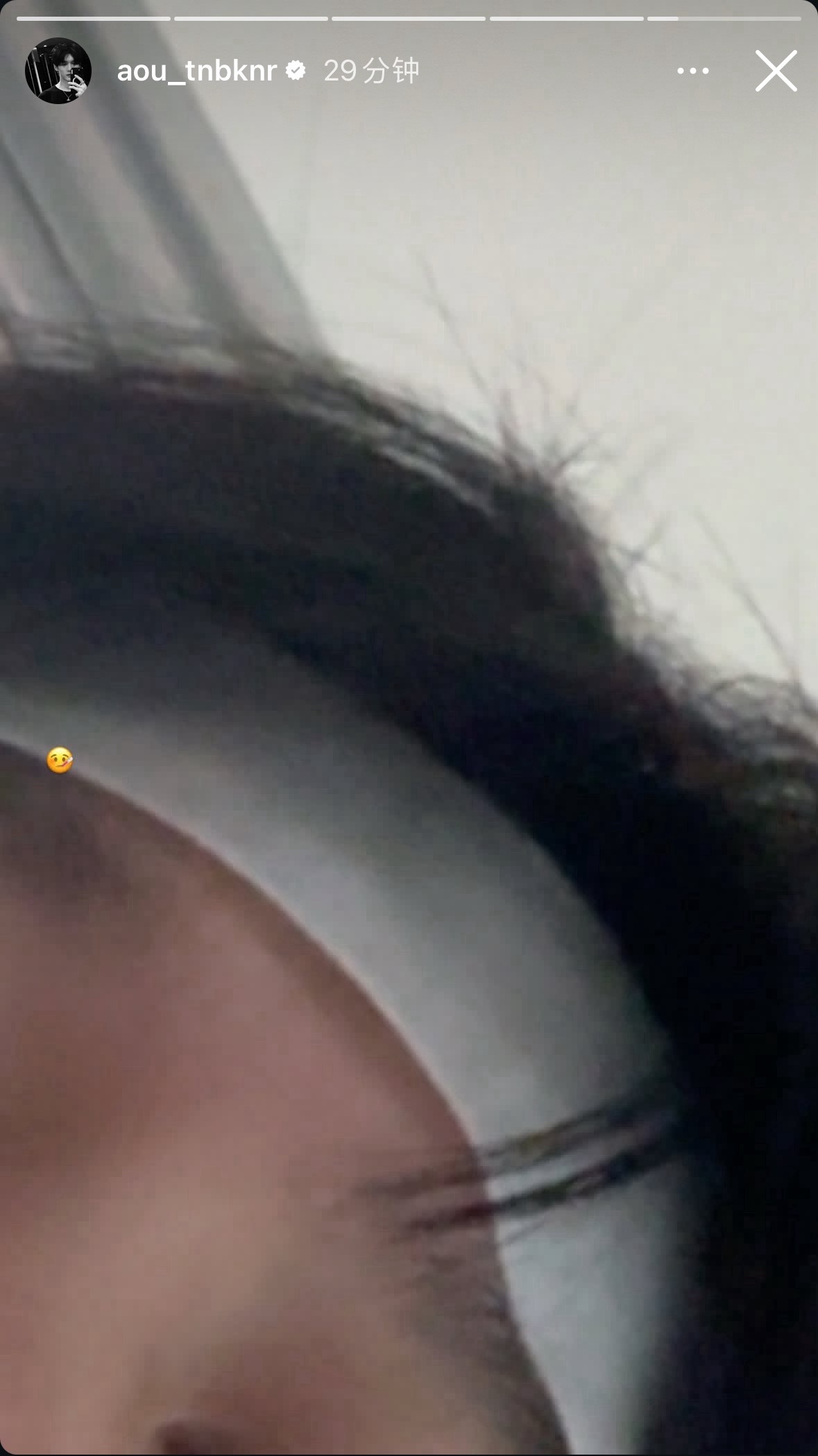aouboom 小脆皮🐶，好好休息早日康复呐