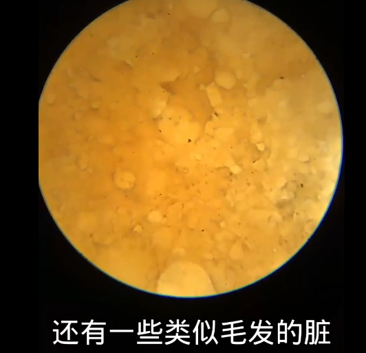 连吃7天麻辣烫身体的变化连吃七天你还真胆大，别说麻辣好不好，就单说麻辣烫中的丸子