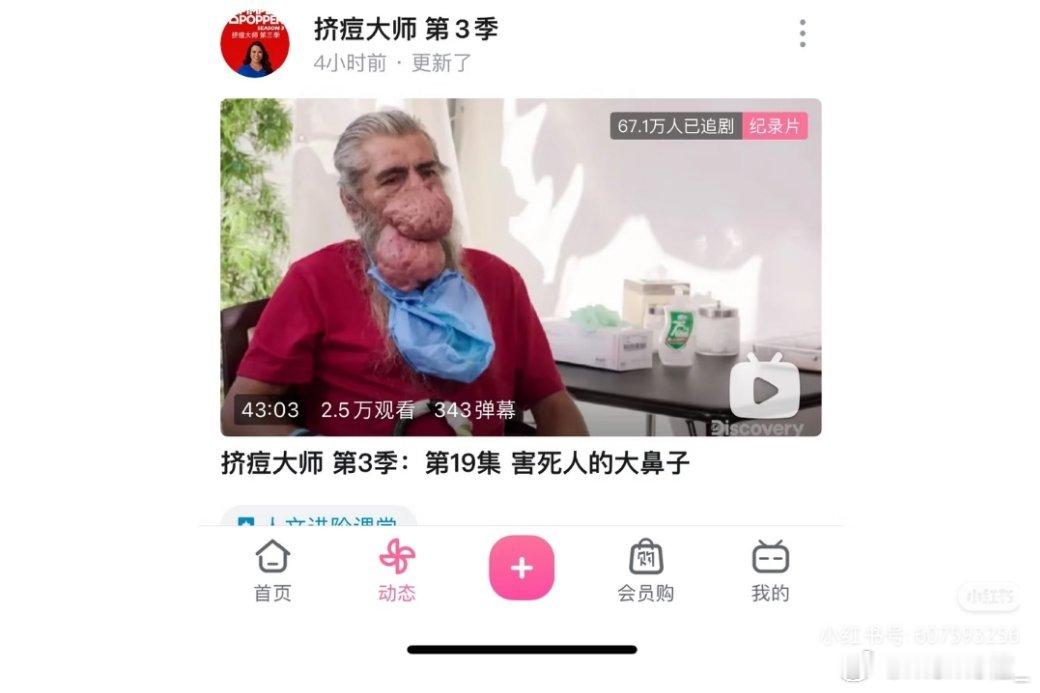 美国普通人生活究竟有多困难 以前很爱看的一个纪录片叫《挤痘大师》，以前一直疑惑，