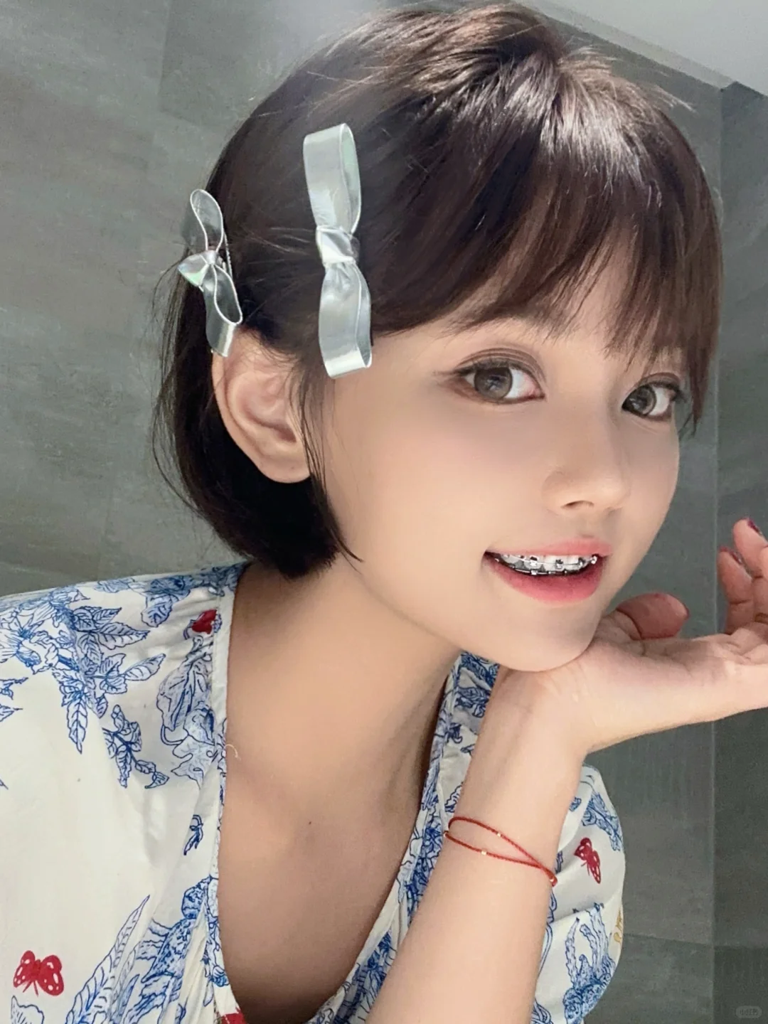 五年正畸人❗️谁懂啊❗️