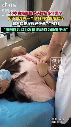 “心大的没边了！”9月浙江杭州，一40岁女子婚后多年没有怀孕，因下肢持续浮肿一个