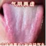 六味地黄芄的黄金搭配，看舌象辨认，对症调理！
 
1、六味地黄芄+补中益气芄
辩