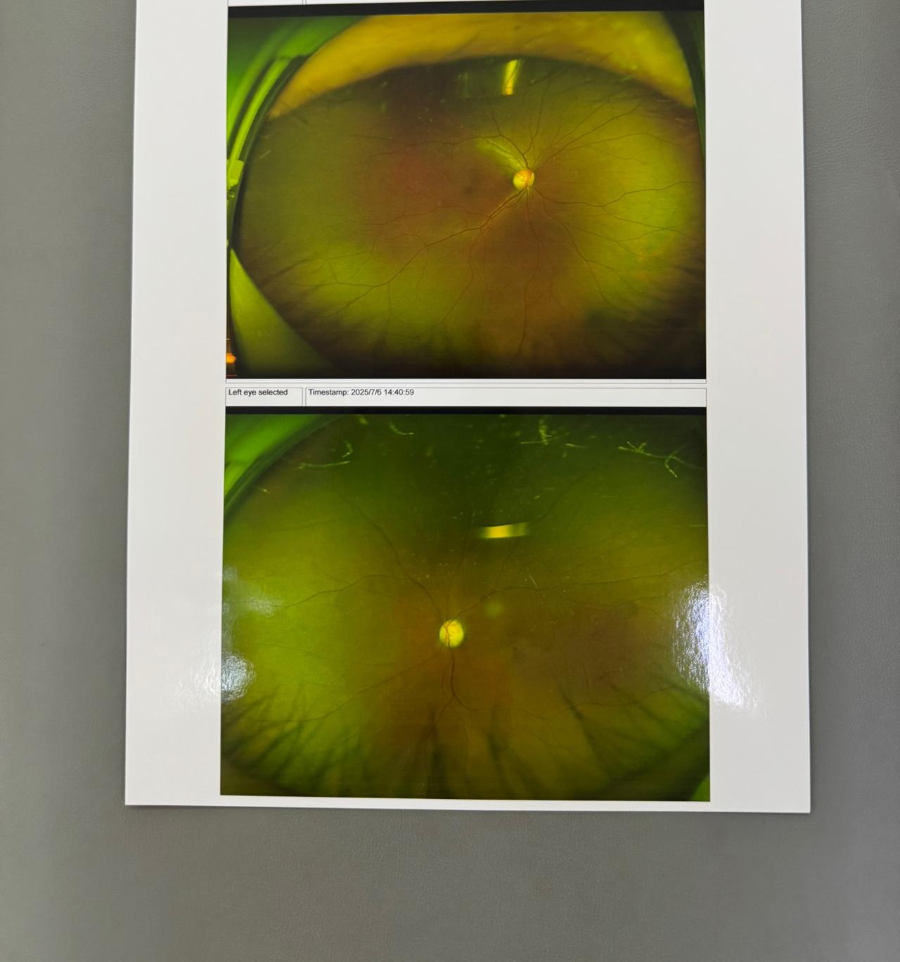 由于我一年没有来到头条，也没有写文章，也没有旅游，耽误了头条的收益，原因是我得了