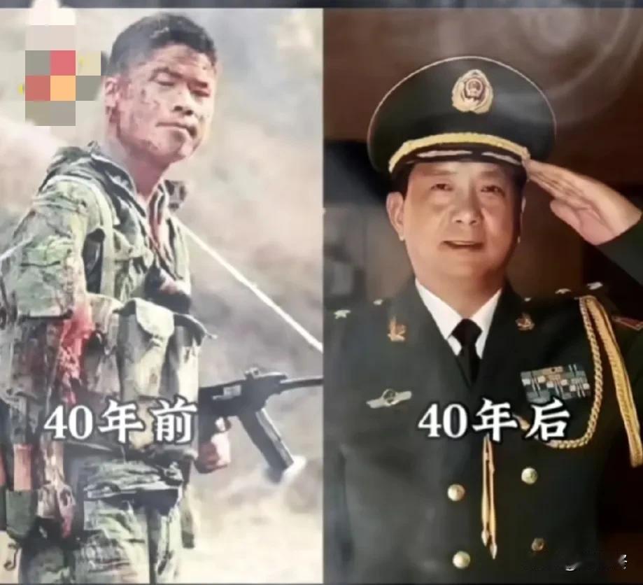 老山第一捕俘手！
1984年老山战役中，手臂被炸伤他用匕首切断连着骨头的肉，把断