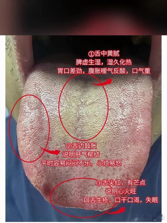 中气与胃气：身体里的根基与活力，决定你吃得香不香！李东垣在《脾胃论》里说得明白：