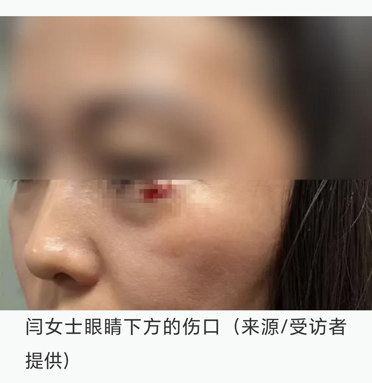 “飞来横祸啊！”黑龙江，一女子躺在火车下铺休息，突然从上铺掉下来一手机，猛的砸在