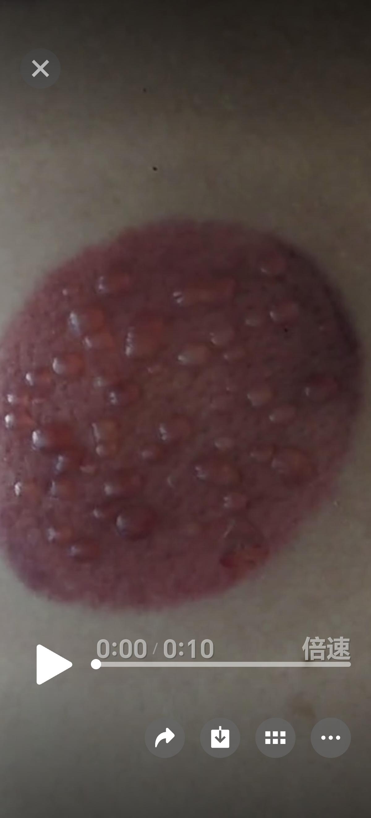 查出血脂稠后一个来月了，医生开的瑞舒伐他丁吃完了。今天没吃药，头晕晕的感觉又来了