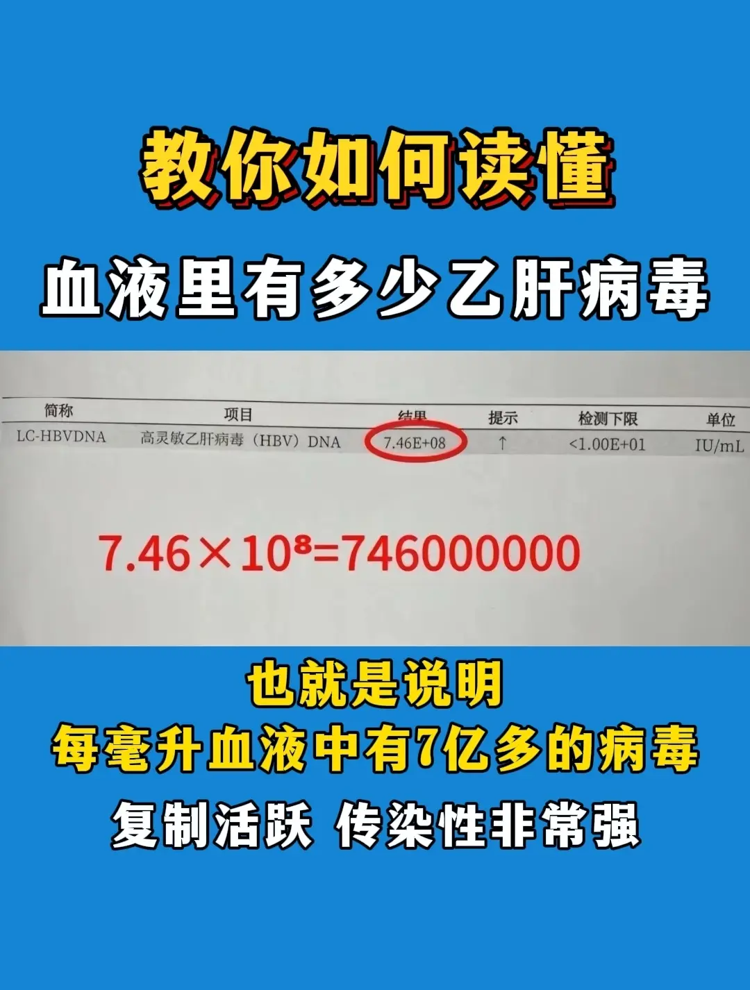 这是一张乙肝DNA病毒定量检测报告单。我们首先看到结果显示是7.46E...