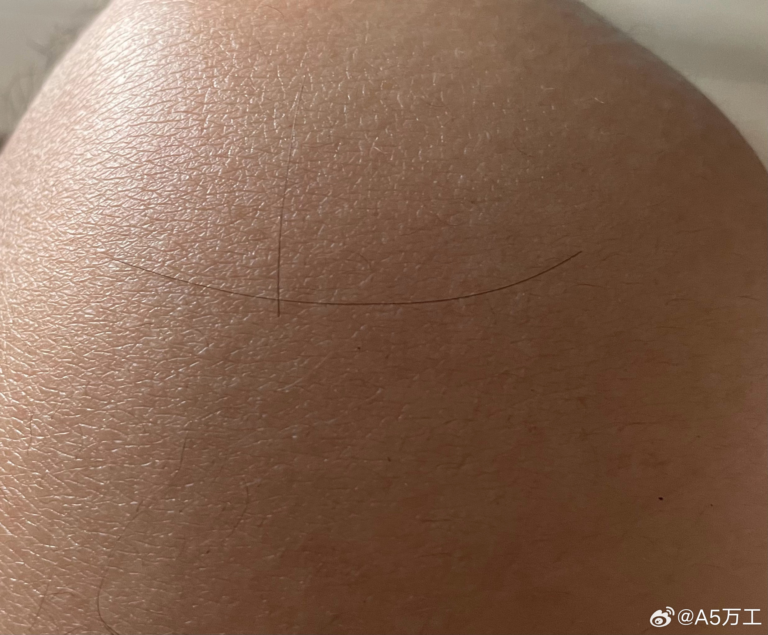 发现当年接近30来岁的时候开始有掉头发的趋势，头顶比以前稀疏了不少。后来我还没事