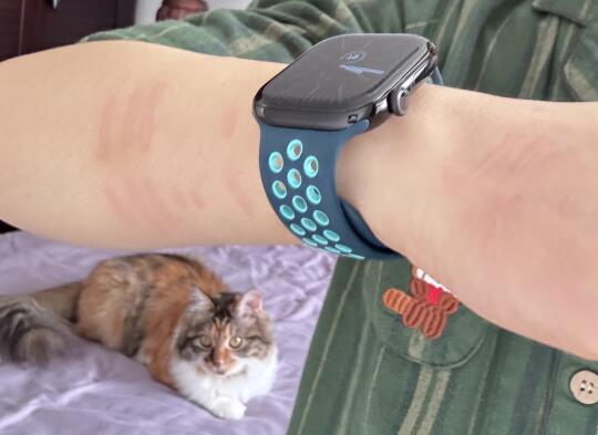 养猫哪有不被咬的